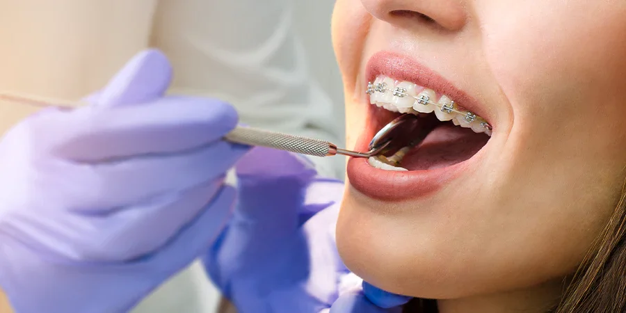 Sí soy adulto ¿la ortodoncia es para mi?